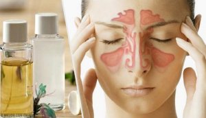 Verstopte sinussen: drie effectieve behandelingen