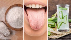 Witte aanslag op de tong kan worden verholpen met acht natuurlijke middelen