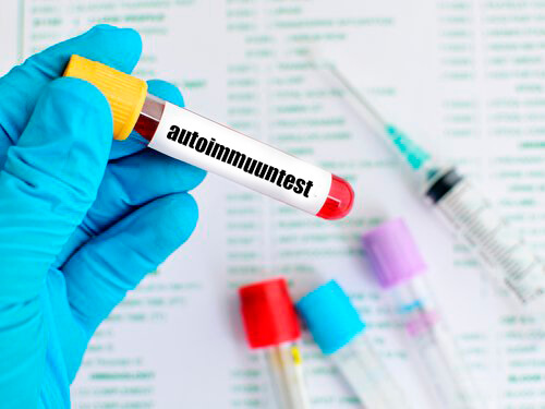 Auto immuun test voor SLE