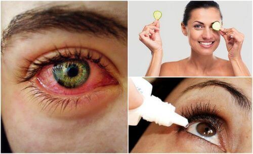 Droge ogen syndroom: Hoe kun je het natuurlijk bestrijden