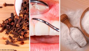 Pak tandvleesontstekingen aan met deze natuurlijke remedies