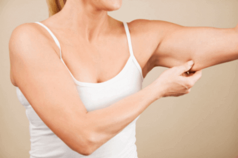 Slanke armen door vet te verminderen