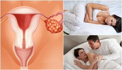 7 symptomen van eierstokkanker die elke vrouw moet kennen