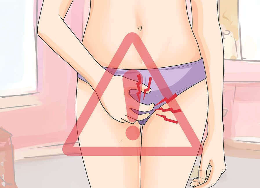 Vaginale kriebel: vier doeltreffende behandelingen