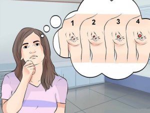 De verschillende soorten borstkanker, symptomen en behandeling