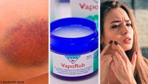 Elf verrassende manieren om de beroemde Vicks VapoRub te gebruiken