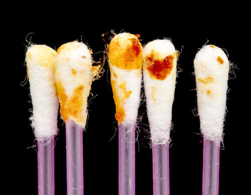 Wat zijn de functies van oorsmeer?