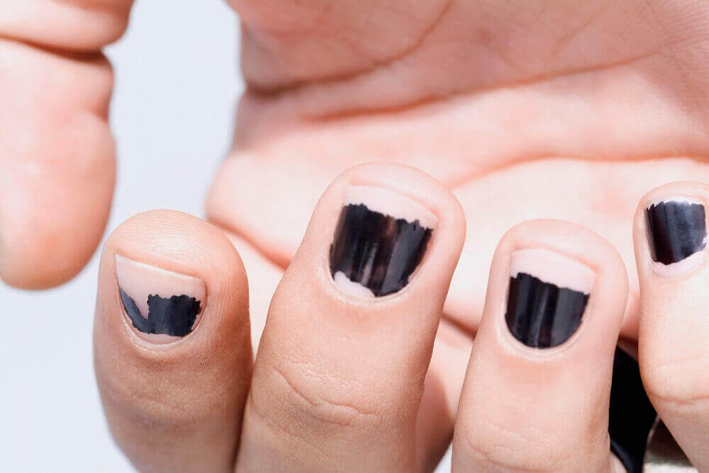 Afgebladderde nagellak