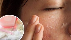 De beste herstellende gezichtsmaskers met baking soda
