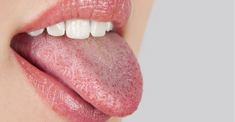 Beginstadium van diabetes: een droge mond en dorst