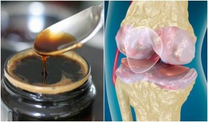 Versterk je botten en gewrichten met deze remedie