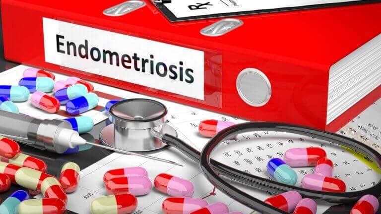 Map waar behandelingen in staan voor de symptomen van endometriose