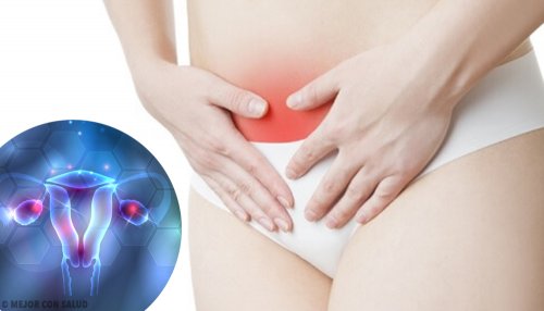 Symptomen van endometriose en hoe je ze kunt behandelen
