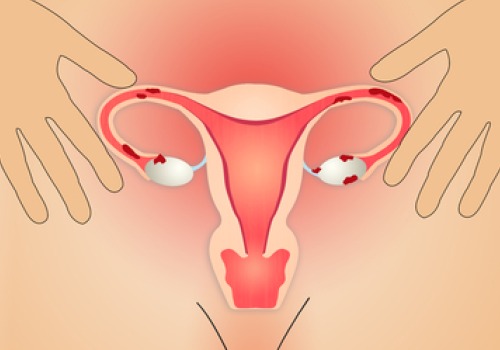 Afbeelding van de eierstokken en de baarmoeder