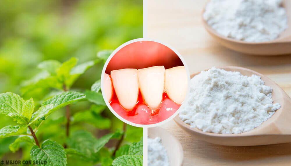 Tandvleesontsteking aanpakken met enkele doeltreffende huismiddeltjes