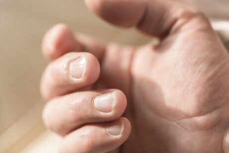Strepen op de vingernagels