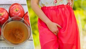 Vaginale jeuk en een branderig gevoel verzachten met deze remedies