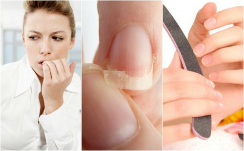 8 redenen waarom je nagels broos zijn