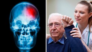 Wat is een TIA of miniberoerte en hoe stel je het vast?