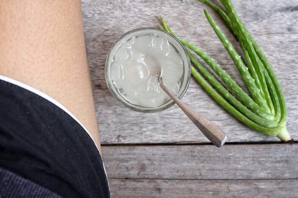 Behandelingen voor spataderen aloeveragel