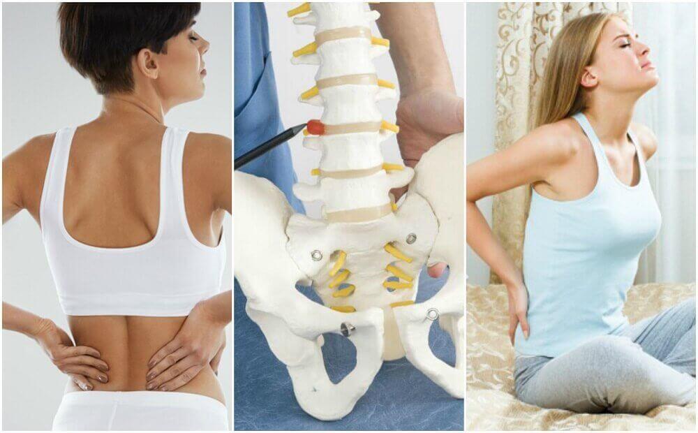 Acht medische oorzaken van rugpijn
