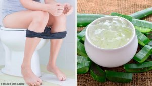 Behandelingen tegen aambeien