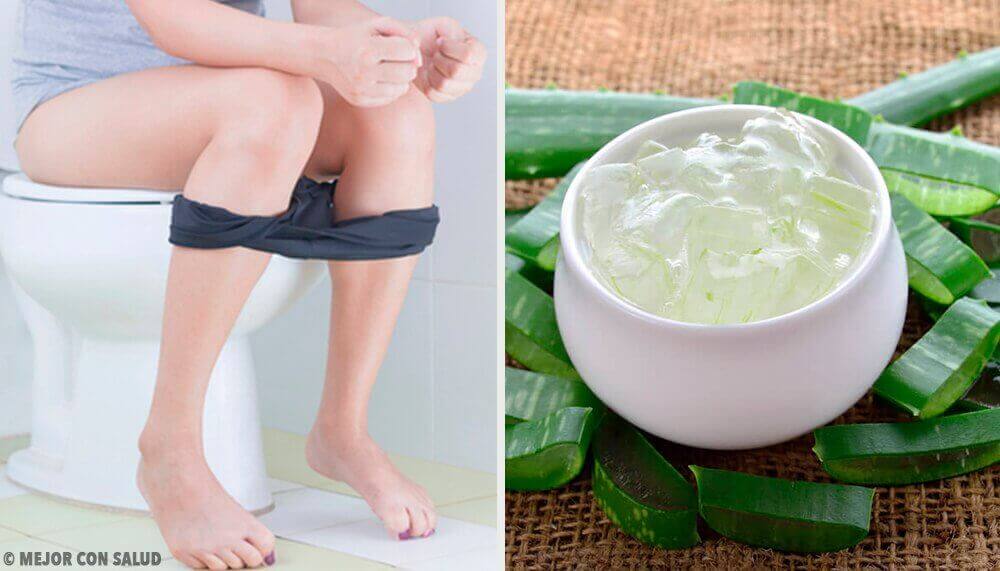 Behandelingen tegen aambeien