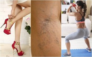 Spataderen kan je voorkomen met 10 handige tips