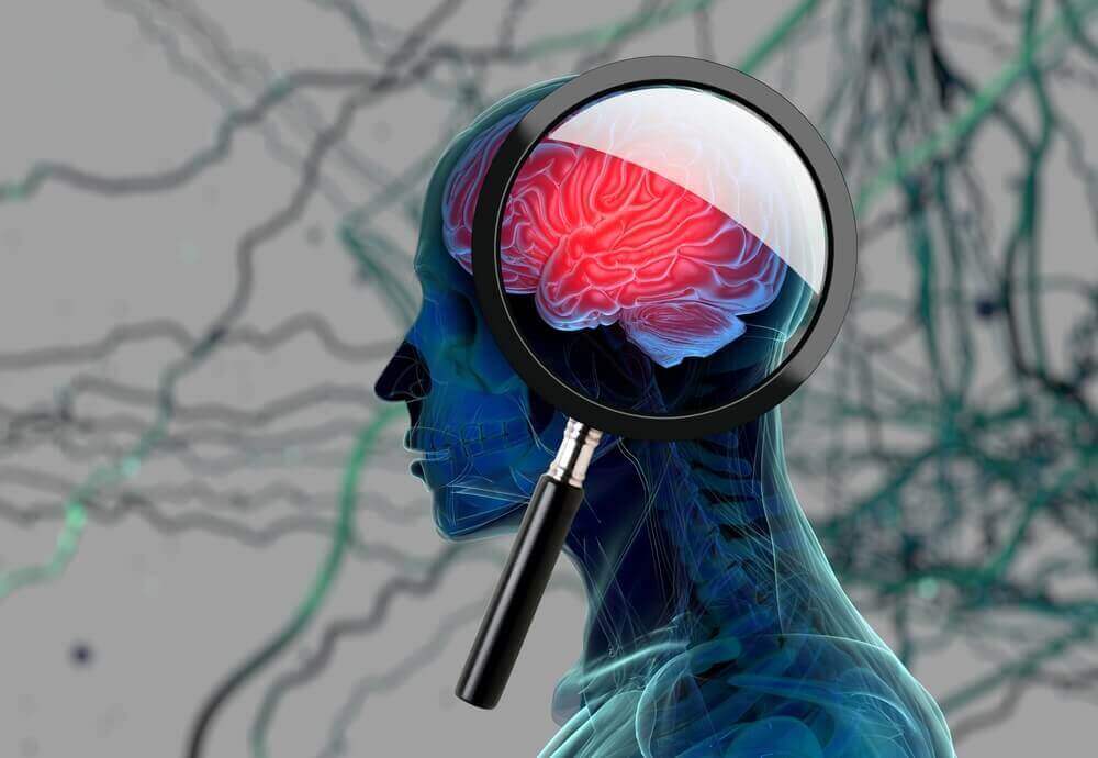 Signalen van Alzheimer, effect op het geheugen
