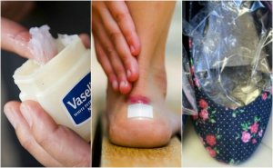 Zijn je schoenen de oorzaak van blaren? 7 oplossingen om dit te voorkomen