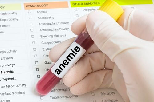 Anemie