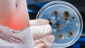 Leer de soorten en oorzaken van een vaginale infectie kennen