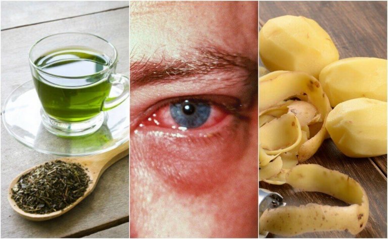 De 8 beste huismiddeltjes tegen een oogontsteking
