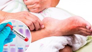 5 veel voorkomende oorzaken van een hoog gehalte urinezuur