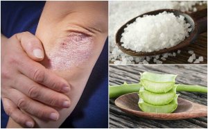 Schimmel kan je bestrijden met deze 5 natuurlijke oplossingen