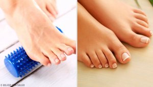 Kan je een eind maken aan eeltknobbels zonder chirurgie?