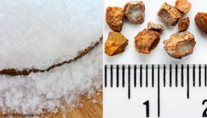 7 zelfgemaakte remedies om nierstenen te verwijderen