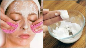 Ga puistjes tegen met deze behandelingen met baking soda