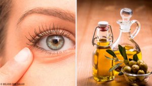 6 natuurlijke remedies voor conjunctivitis