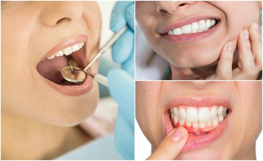 7 symptomen die op een tandheelkundige infectie kunnen duiden