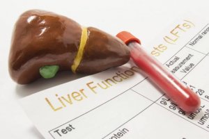 Vijf redenen van een verhoogd alkalische fosfatase