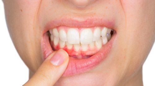 symptomen die op een tandheelkundige infectie kunnen duiden