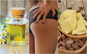 Verminder striae met deze 5 huismiddeltjes