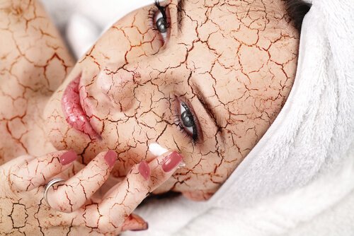 Peelings helpen tegen droge huid