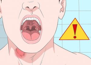 5 mogelijke tekenen van knobbeltjes op de stembanden