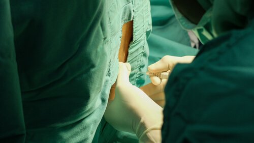 Een lendenstreekpunctie kan exact bepalen of je een hersenvliesontsteking hebt