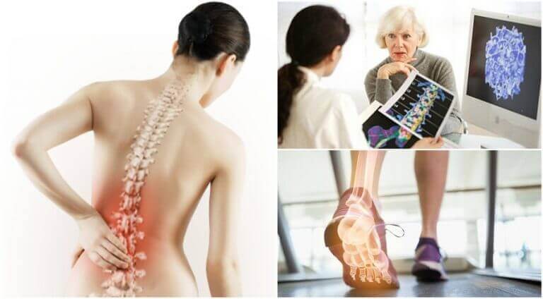 Vrouw die meer te weten krijgt over osteoporose
