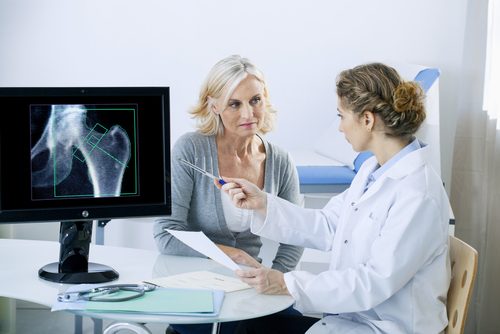 Vrouw die informatie te horen krijgt over osteoporose