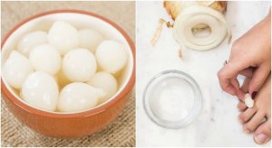 Los eelt op je voeten op met dit 100% natuurlijke middel!