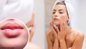 13 manieren waarop je gezicht je op een gezondheidsprobleem kan wijzen